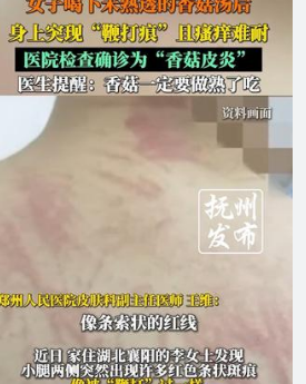 女子吃了未熟香菇身体像被“鞭打”