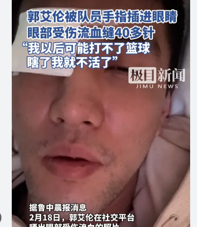 <strong>郭艾伦眼睛受重伤:瞎了我就不活了</strong>