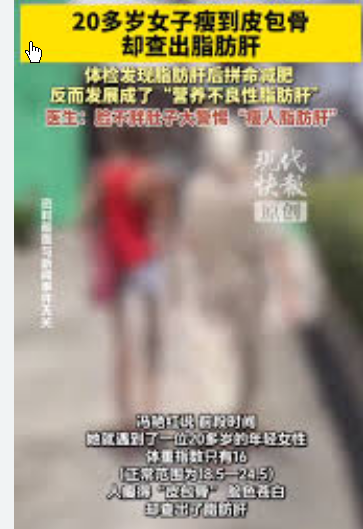 <strong>20岁女子瘦到皮包骨查出脂肪肝</strong>