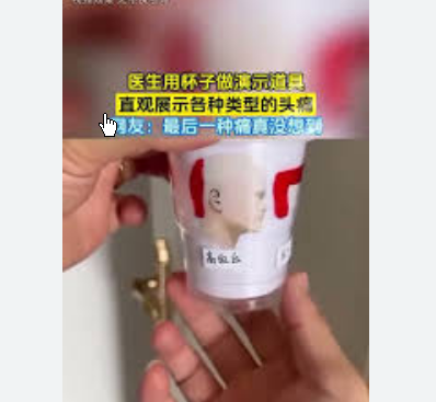 <strong>医生用杯子展示各种类型的头痛</strong>